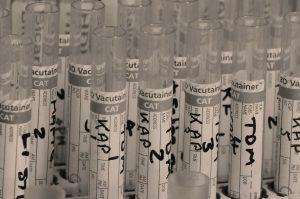 A series of test tubes set up for water testing.